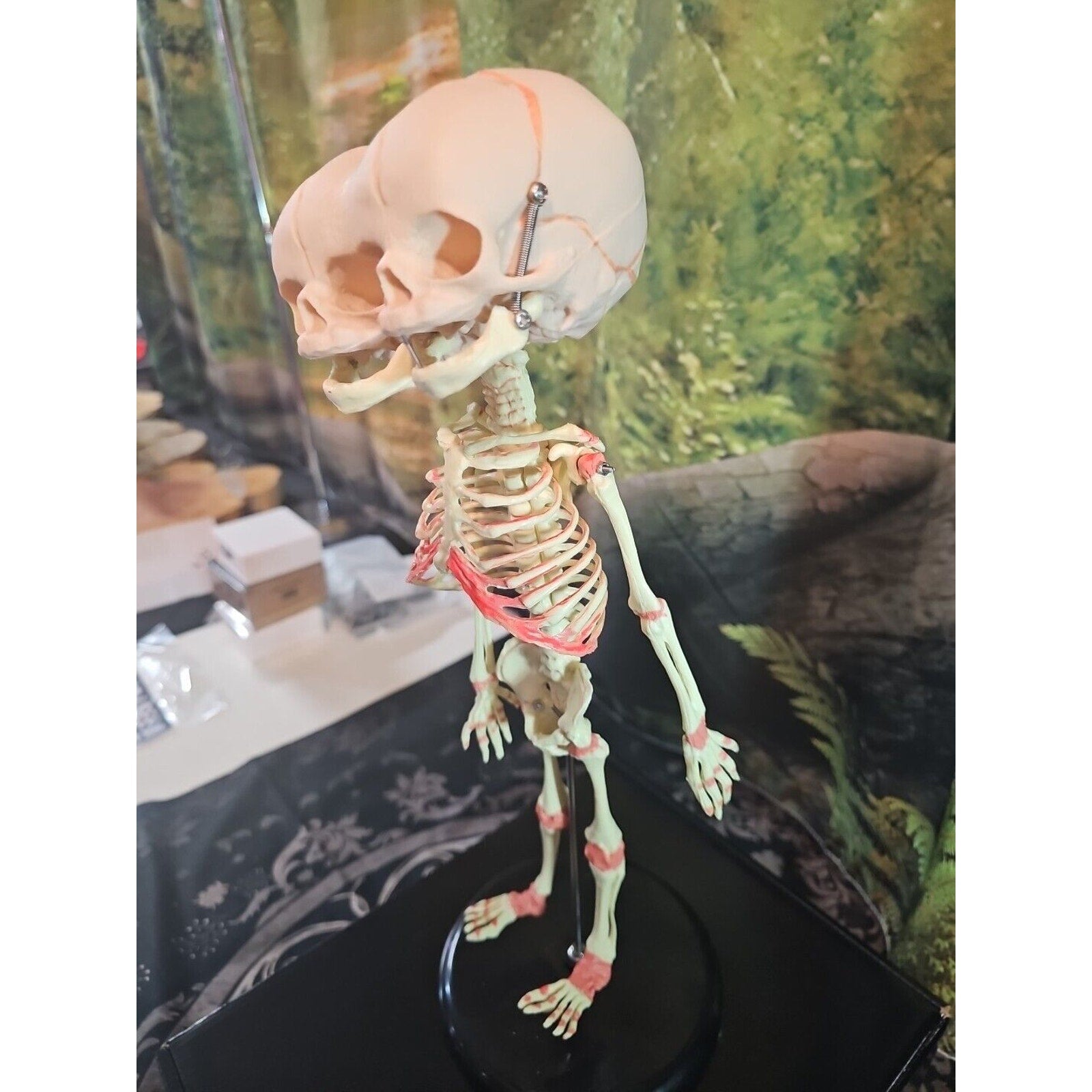 Pinyl vinyl chloride skeleton of abnormal infant