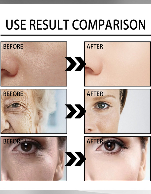 Load image into Gallery viewer, Snail Cream - Fading Wrinkle French Lines - Replenishment Firming Skin- Anti-Aging
