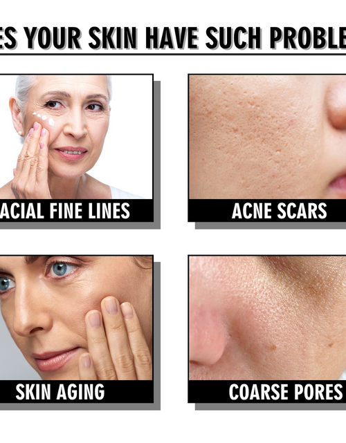 Load image into Gallery viewer, Snail Cream - Fading Wrinkle French Lines - Replenishment Firming Skin- Anti-Aging
