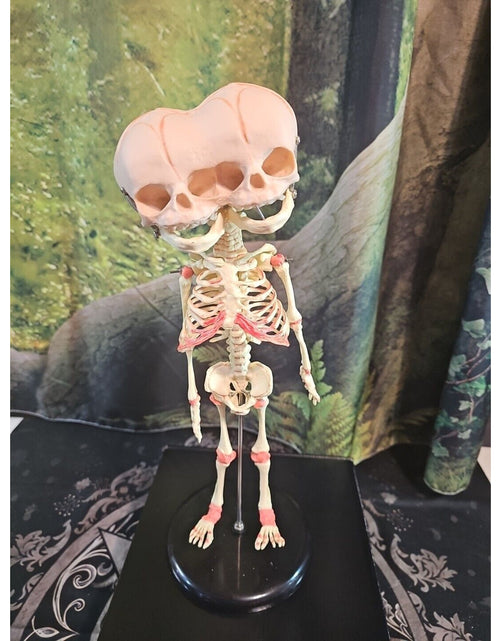 Load image into Gallery viewer, Pinyl vinyl chloride skeleton of abnormal infant
