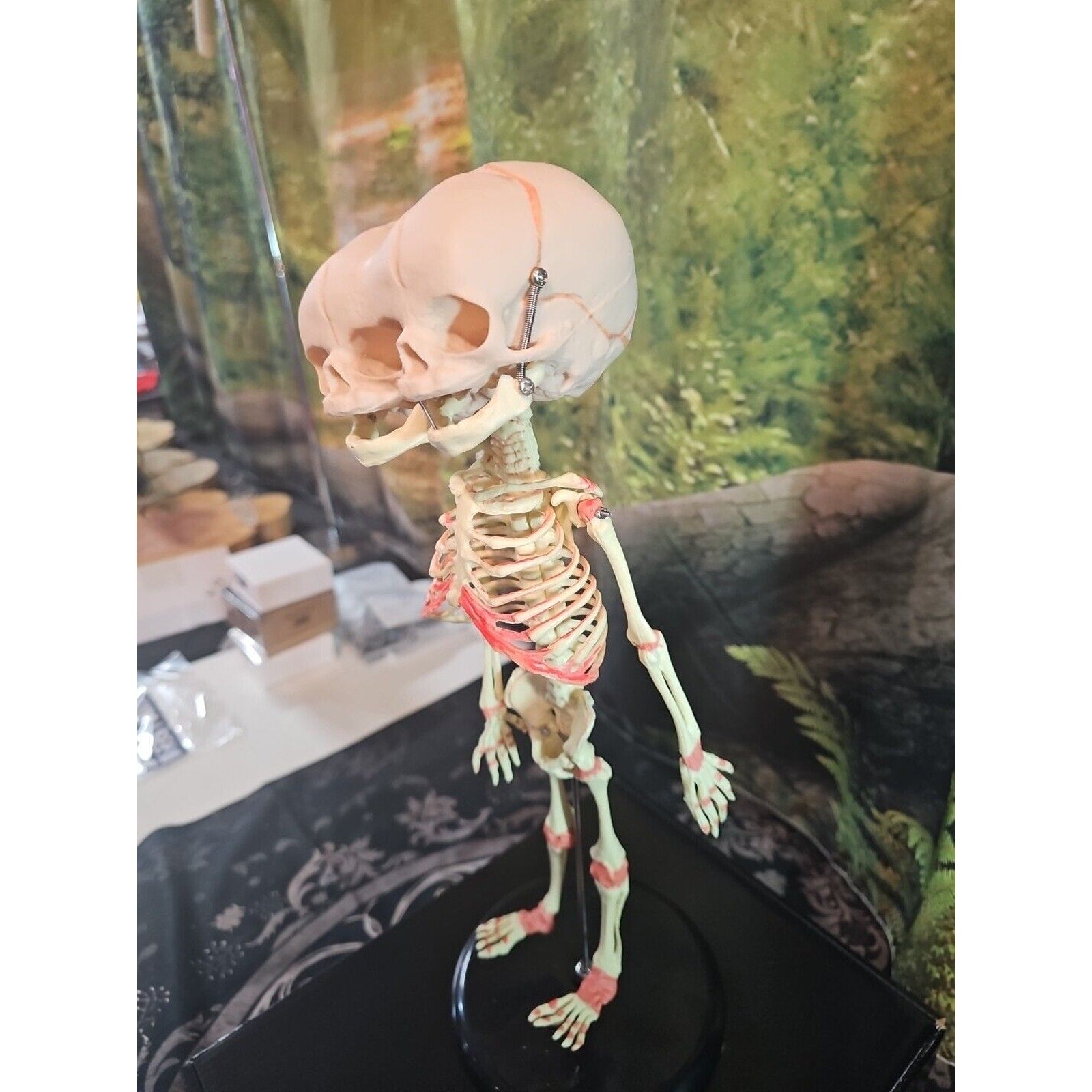 Pinyl vinyl chloride skeleton of abnormal infant