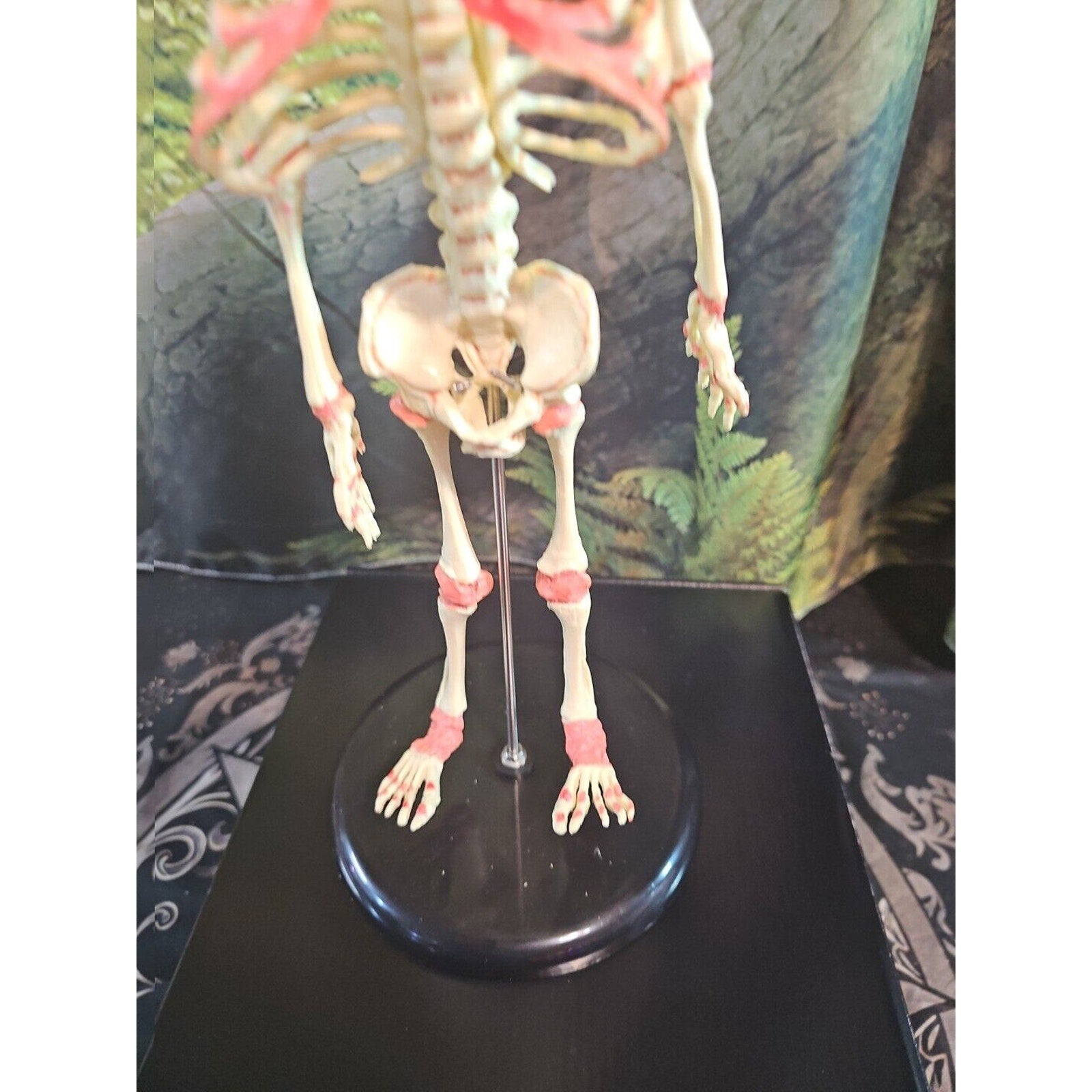 Pinyl vinyl chloride skeleton of abnormal infant