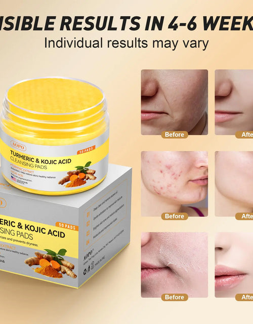 Load image into Gallery viewer, Kojic Acid and Turmeric Cleansing Pads, 50 Pcs, for Face Cleansing and Exfoliation
