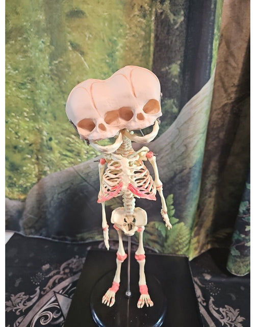 Load image into Gallery viewer, Pinyl vinyl chloride skeleton of abnormal infant
