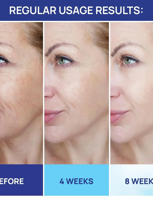 Load image into Gallery viewer, Retinol Cream for Face   Collagen and Retinol Moisturizer with Hyaluronic Acid
