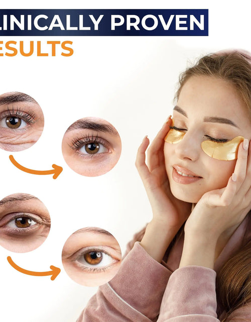 Load image into Gallery viewer, Under Eye Patches For Puffy Eyes And Dark Circles 30 Pair Eye Masks Anti Aging
